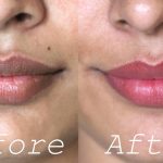 Home Remedies to Lighten Dark Lips 