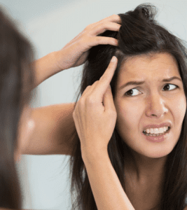 അകാലനര മാറ്റാനുളള  ഒറ്റമൂലി | Home Remedies for Premature Grey Hair 