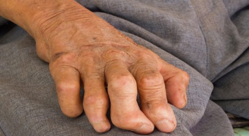 കുഷ്ഠം മാറാനുള്ള ഒറ്റമൂലികൾ – Home Remedies for Leprosy – Kushttam Maaranulla Ottamoolikal