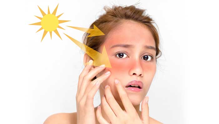  Home Remedies to Remove Sun Tan from Face 